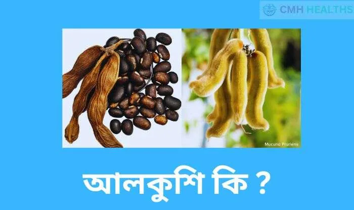 আলকুশি